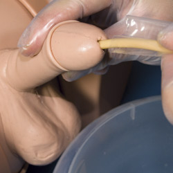 Pracitse of Aseptic catheterisation using aseptio catherisation sleeves